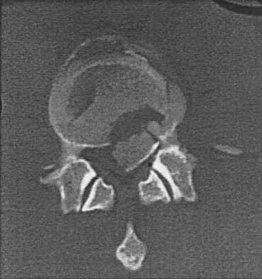 General Orthopedics 2026 Practice Questions: Set 15 (Solved) - Figure 124