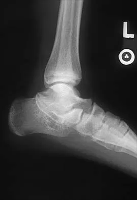 General Orthopedics 2026 Practice Questions: Set 15 (Solved) - Figure 132