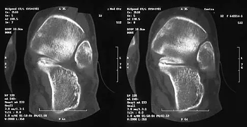General Orthopedics 2026 Practice Questions: Set 15 (Solved) - Figure 134