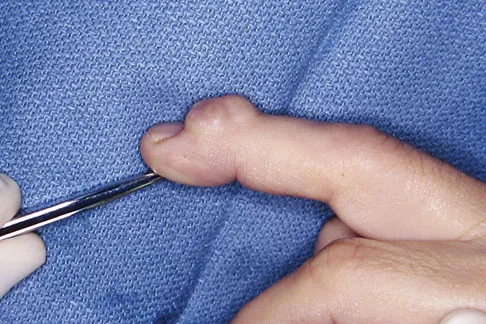 General Orthopedics 2026 Practice Questions: Set 15 (Solved) - Figure 135