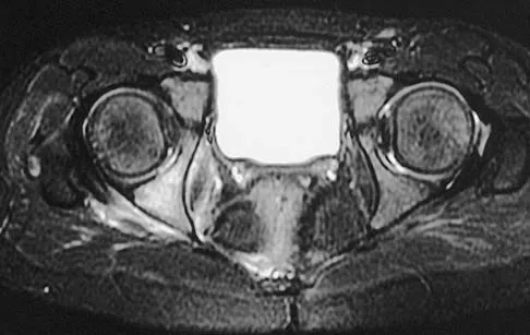 General Orthopedics 2026 Practice Questions: Set 15 (Solved) - Figure 17