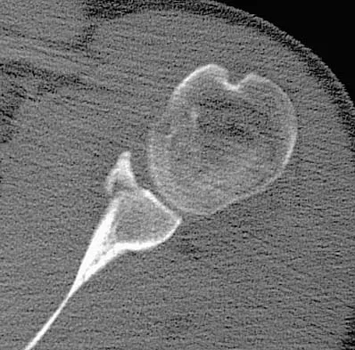 General Orthopedics 2026 Practice Questions: Set 15 (Solved) - Figure 18