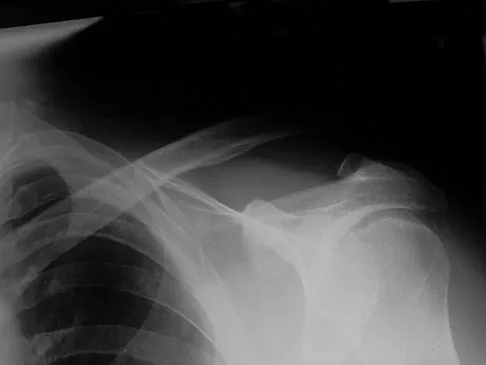 General Orthopedics 2026 Practice Questions: Set 15 (Solved) - Figure 21