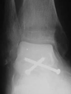 General Orthopedics 2026 Practice Questions: Set 15 (Solved) - Figure 23