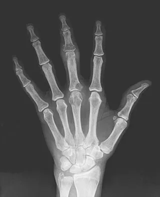 General Orthopedics 2026 Practice Questions: Set 15 (Solved) - Figure 24