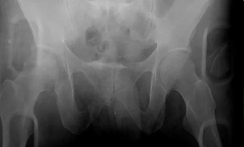 General Orthopedics 2026 Practice Questions: Set 15 (Solved) - Figure 27