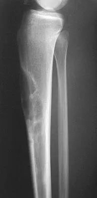 General Orthopedics 2026 Practice Questions: Set 15 (Solved) - Figure 32