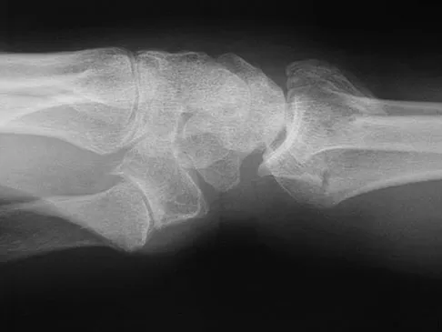 General Orthopedics 2026 Practice Questions: Set 15 (Solved) - Figure 34