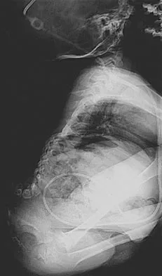 General Orthopedics 2026 Practice Questions: Set 15 (Solved) - Figure 37