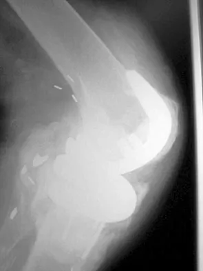 General Orthopedics 2026 Practice Questions: Set 15 (Solved) - Figure 39