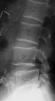 General Orthopedics 2026 Practice Questions: Set 15 (Solved) - Figure 42