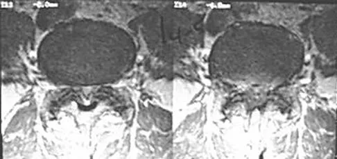 General Orthopedics 2026 Practice Questions: Set 15 (Solved) - Figure 43