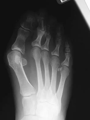 General Orthopedics 2026 Practice Questions: Set 15 (Solved) - Figure 45