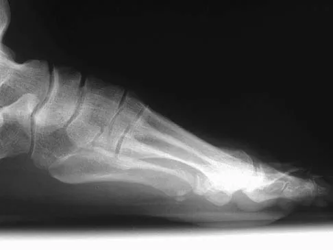 General Orthopedics 2026 Practice Questions: Set 15 (Solved) - Figure 46