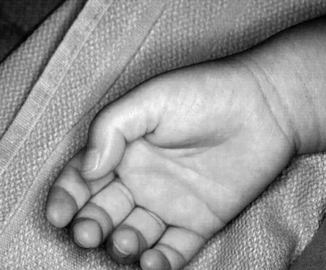 General Orthopedics 2026 Practice Questions: Set 15 (Solved) - Figure 51