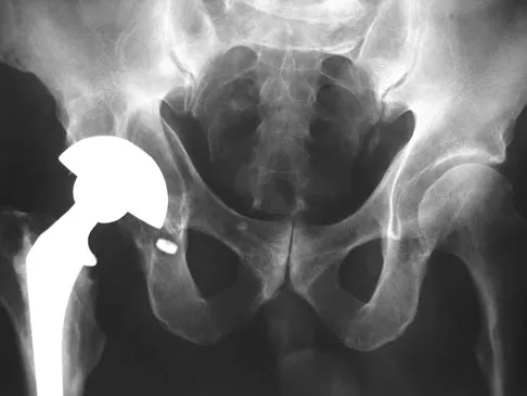 General Orthopedics 2026 Practice Questions: Set 15 (Solved) - Figure 55