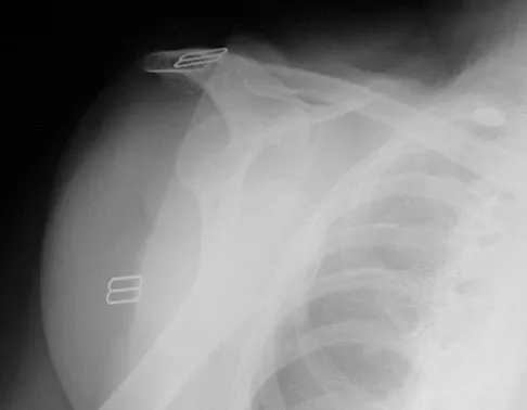 General Orthopedics 2026 Practice Questions: Set 15 (Solved) - Figure 56