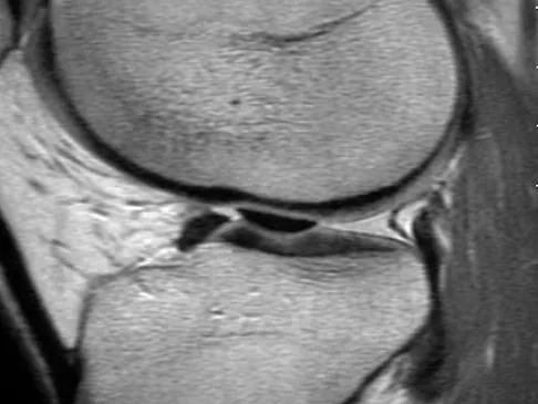 General Orthopedics 2026 Practice Questions: Set 15 (Solved) - Figure 63