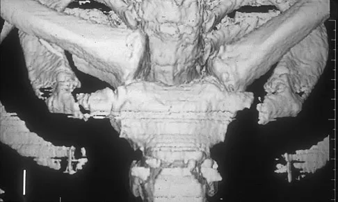 General Orthopedics 2026 Practice Questions: Set 15 (Solved) - Figure 65