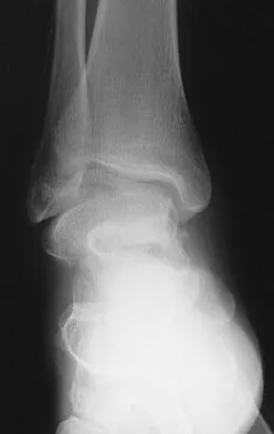 General Orthopedics 2026 Practice Questions: Set 15 (Solved) - Figure 70