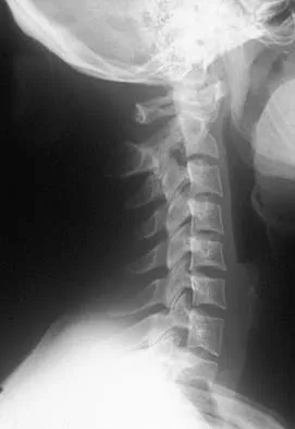 General Orthopedics 2026 Practice Questions: Set 15 (Solved) - Figure 75