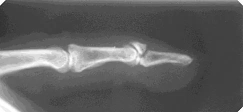 General Orthopedics 2026 Practice Questions: Set 15 (Solved) - Figure 79