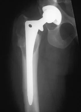 General Orthopedics 2026 Practice Questions: Set 15 (Solved) - Figure 8