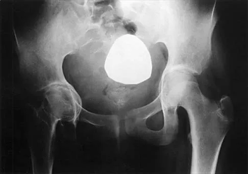 General Orthopedics 2026 Practice Questions: Set 15 (Solved) - Figure 80