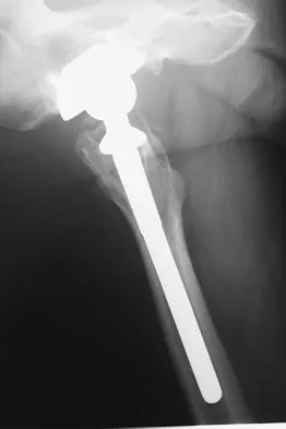 General Orthopedics 2026 Practice Questions: Set 15 (Solved) - Figure 85