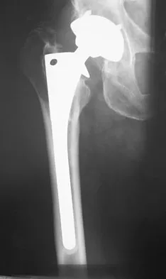 General Orthopedics 2026 Practice Questions: Set 15 (Solved) - Figure 86