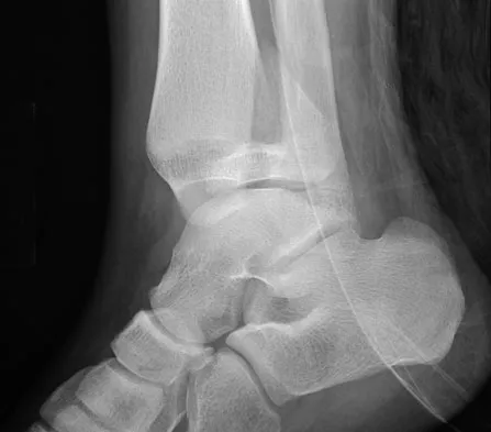 General Orthopedics 2026 Practice Questions: Set 15 (Solved) - Figure 92