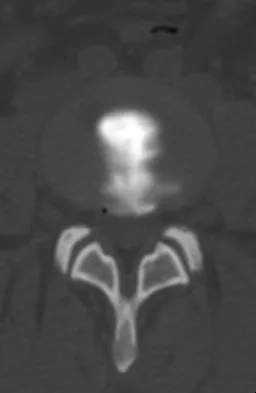 General Orthopedics 2026 Practice Questions: Set 15 (Solved) - Figure 96