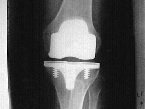 General Orthopedics 2026 Practice Questions: Set 15 (Solved) - Figure 98