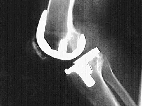 General Orthopedics 2026 Practice Questions: Set 15 (Solved) - Figure 99