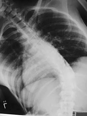 General Orthopedics Board Review 2026: High-Yield MCQs (Set 16) - Figure 100