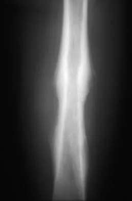 General Orthopedics Board Review 2026: High-Yield MCQs (Set 16) - Figure 104