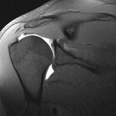 General Orthopedics Board Review 2026: High-Yield MCQs (Set 16) - Figure 108