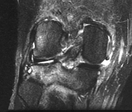 General Orthopedics Board Review 2026: High-Yield MCQs (Set 16) - Figure 113