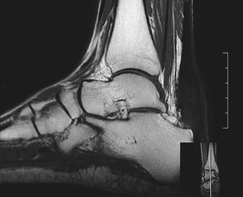 General Orthopedics Board Review 2026: High-Yield MCQs (Set 16) - Figure 116