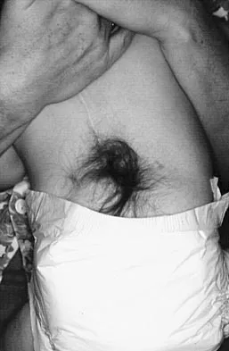 General Orthopedics Board Review 2026: High-Yield MCQs (Set 16) - Figure 118