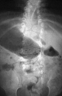 General Orthopedics Board Review 2026: High-Yield MCQs (Set 16) - Figure 119