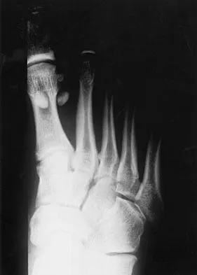 General Orthopedics Board Review 2026: High-Yield MCQs (Set 16) - Figure 127