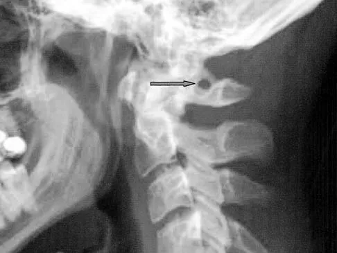 General Orthopedics Board Review 2026: High-Yield MCQs (Set 16) - Figure 13