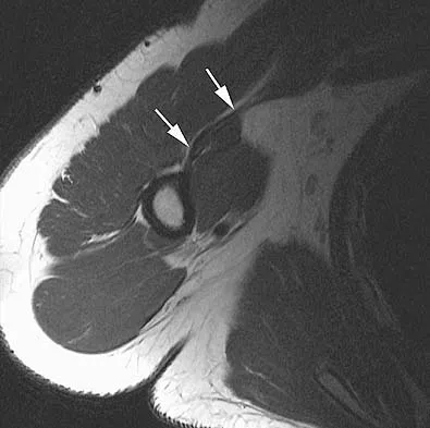 General Orthopedics Board Review 2026: High-Yield MCQs (Set 16) - Figure 17
