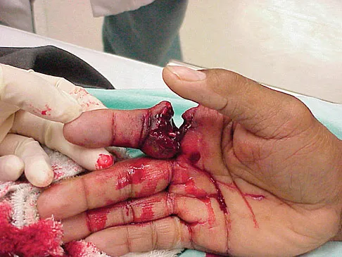 General Orthopedics Board Review 2026: High-Yield MCQs (Set 16) - Figure 22