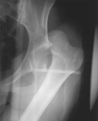 General Orthopedics Board Review 2026: High-Yield MCQs (Set 16) - Figure 24