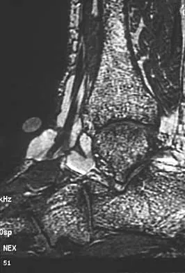 General Orthopedics Board Review 2026: High-Yield MCQs (Set 16) - Figure 27
