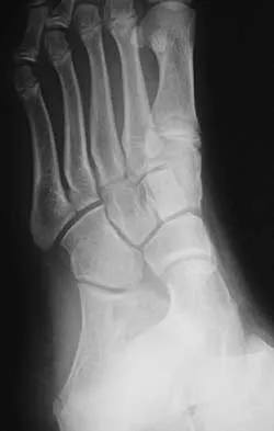 General Orthopedics Board Review 2026: High-Yield MCQs (Set 16) - Figure 30