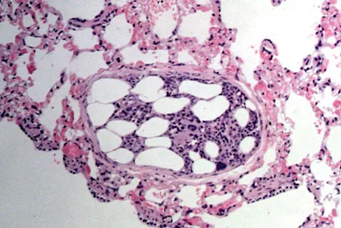 General Orthopedics Board Review 2026: High-Yield MCQs (Set 16) - Figure 38
