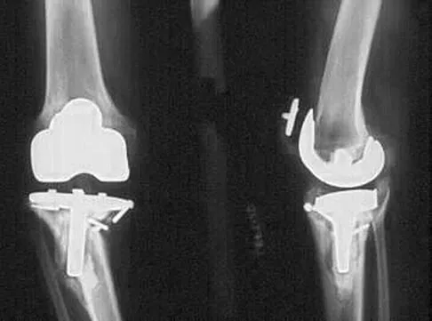 General Orthopedics Board Review 2026: High-Yield MCQs (Set 16) - Figure 4